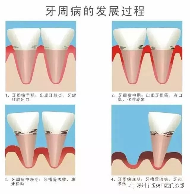 牙龈肿2个月